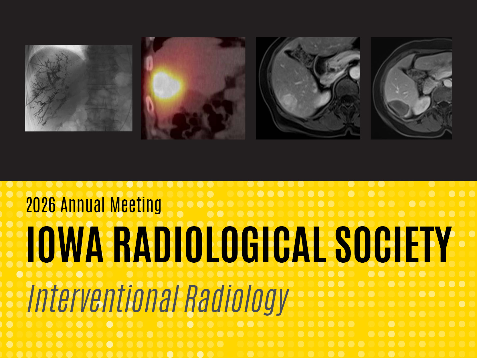 Iowa Radiological Society 2026 Annual Meeting: Interventional Radiology Banner